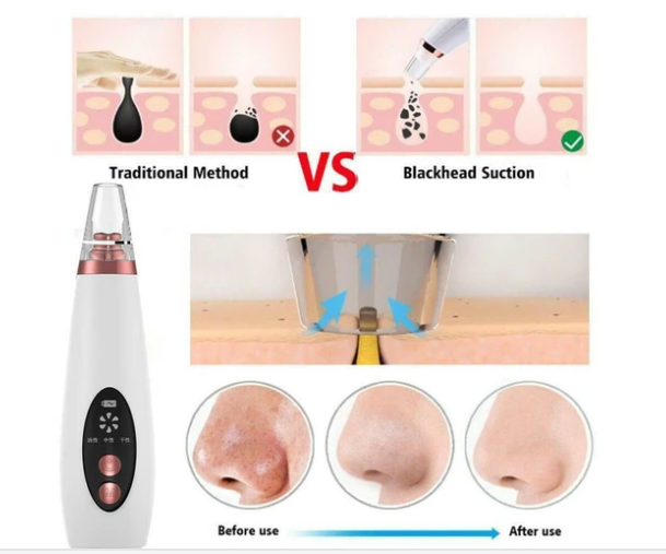 6 in 1 Electric Blackhead Remover Facial Skin Pore Cleaner Vacuum Acne Cleanser